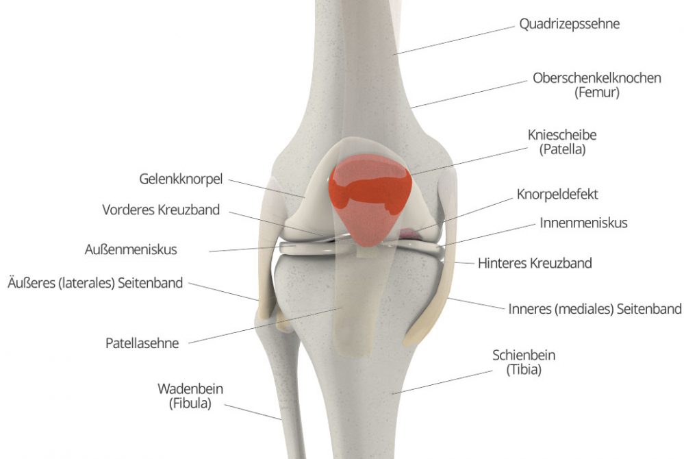 Schmerzen im Knie: Kniescheibe
