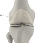 Knorpelexperte Gelenkknorpel